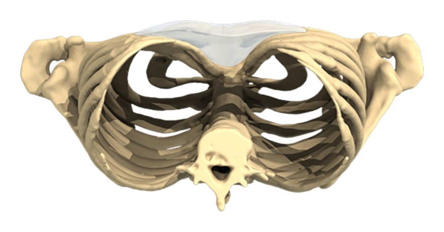 Implantes corporales a medida Anatomik Modeling